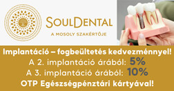 SoulDental Fogászat kedvezmények