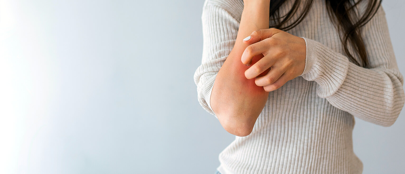 Bőrtünetek és az ételérzékenység