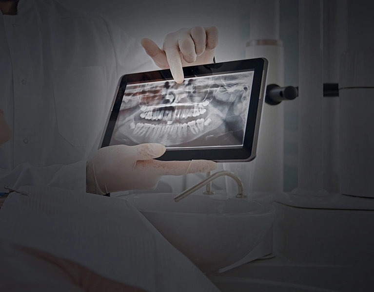 egeszsegpercek-hid-implantatumos-korona
